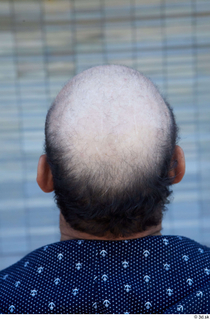 Street  768 bald hair head 0001.jpg